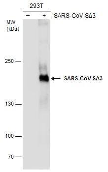 SARS Spike Protein Antibody (7G12)
