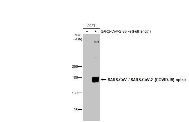 SARS Spike Protein Antibody (1A9)