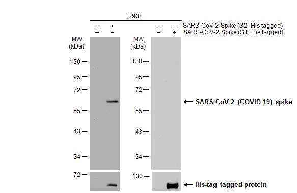 SARS Spike Protein Antibody (1A9)