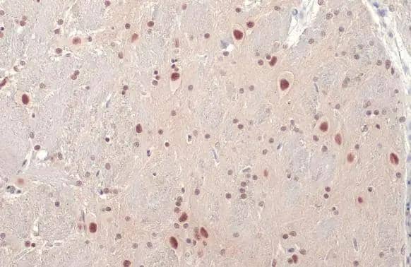 BRM Antibody (HL1114)