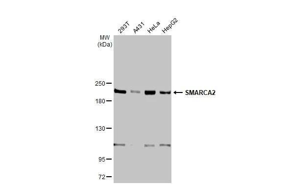 BRM Antibody (HL1114)