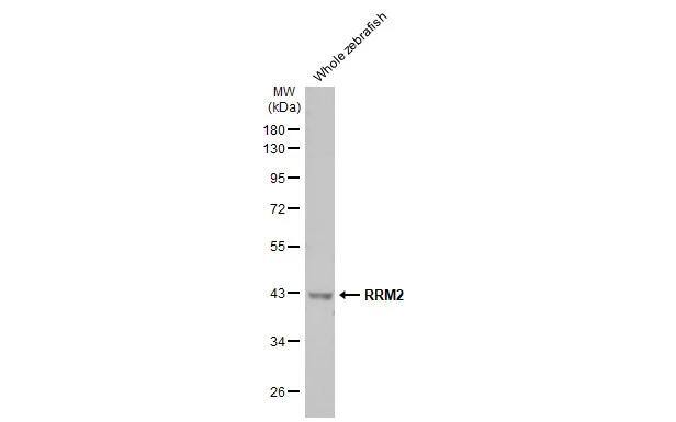 RRM2 Antibody (HL1235)