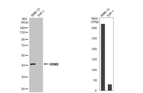 RRM2 Antibody (HL1235)