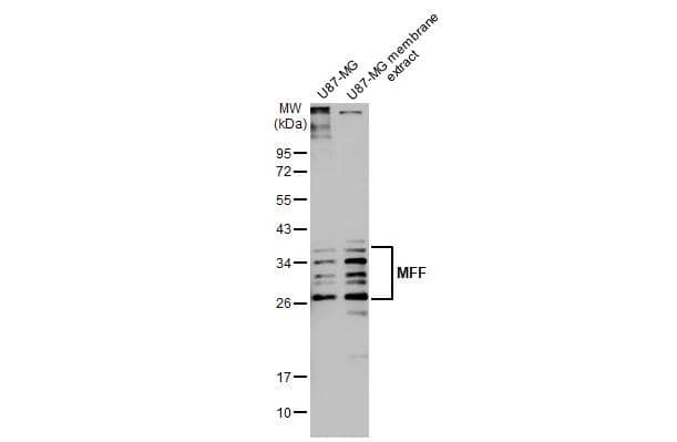 MFF Antibody (HL1313)