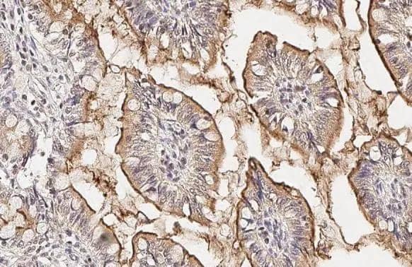 PDE6D Antibody (HL1359)