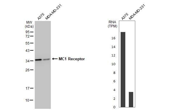 Melanocortin-1 R/MC1R Antibody (HL1470)