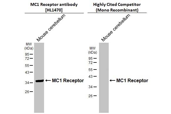 Melanocortin-1 R/MC1R Antibody (HL1470)