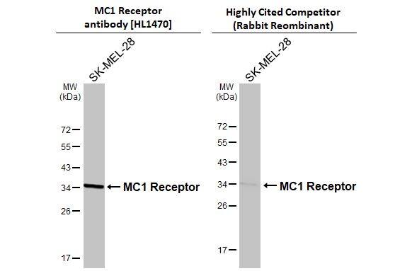 Melanocortin-1 R/MC1R Antibody (HL1470)