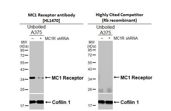 Melanocortin-1 R/MC1R Antibody (HL1470)
