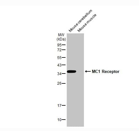 Melanocortin-1 R/MC1R Antibody (HL1470)