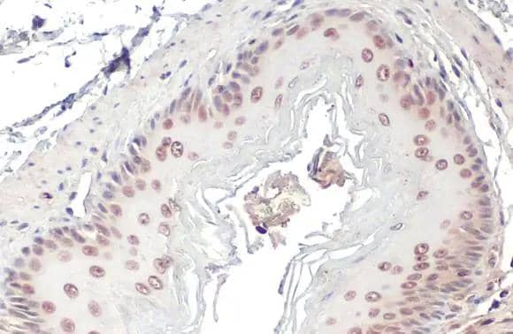 DNA Polymerase beta Antibody (HL1512)