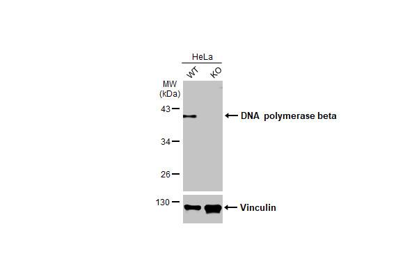 DNA Polymerase beta Antibody (HL1512)