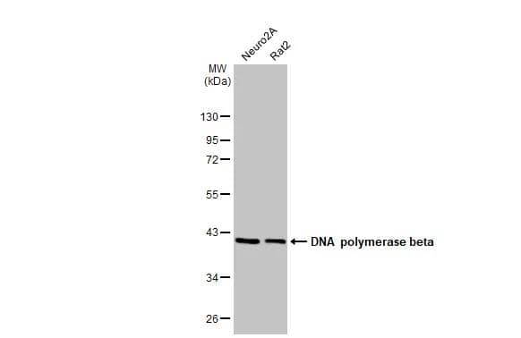 DNA Polymerase beta Antibody (HL1512)
