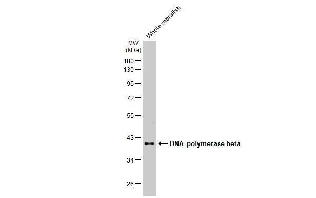 DNA Polymerase beta Antibody (HL1512)