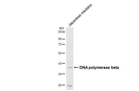 DNA Polymerase beta Antibody (HL1512)