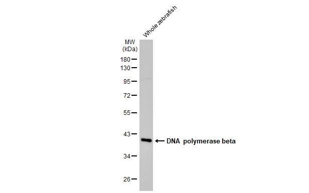 DNA Polymerase beta Antibody (HL1525)