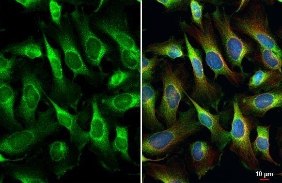 Puromycin-sensitive aminopeptidase/NPEPPS Antibody (HL1531)