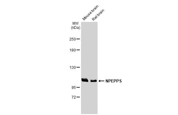 Puromycin-sensitive aminopeptidase/NPEPPS Antibody (HL1531)