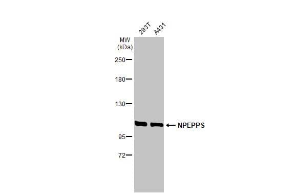Puromycin-sensitive aminopeptidase/NPEPPS Antibody (HL1531)