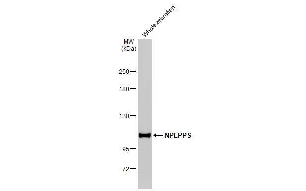 Puromycin-sensitive aminopeptidase/NPEPPS Antibody (HL1531)
