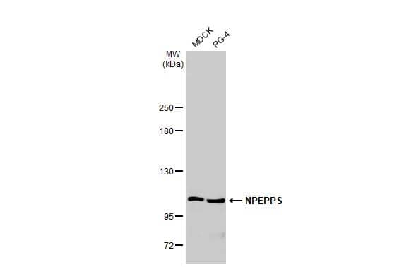 Puromycin-sensitive aminopeptidase/NPEPPS Antibody (HL1531)