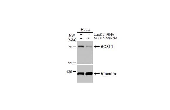 ACSL1 Antibody (HL1651)