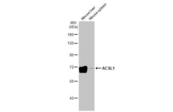 ACSL1 Antibody (HL1651)