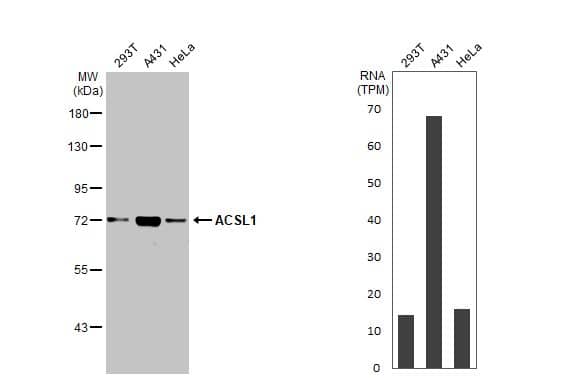 ACSL1 Antibody (HL1651)