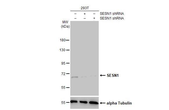 SESN1 Antibody (HL1750)
