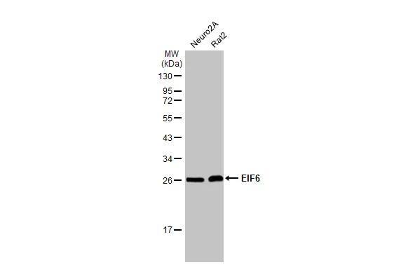 integrin beta 4 binding protein Antibody (HL1758)