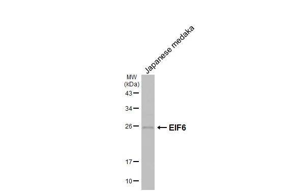 integrin beta 4 binding protein Antibody (HL1758)