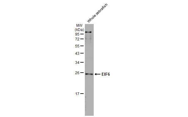 integrin beta 4 binding protein Antibody (HL1758)