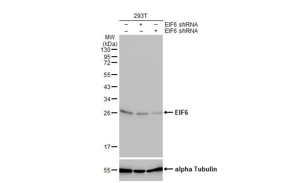 integrin beta 4 binding protein Antibody (HL1758)