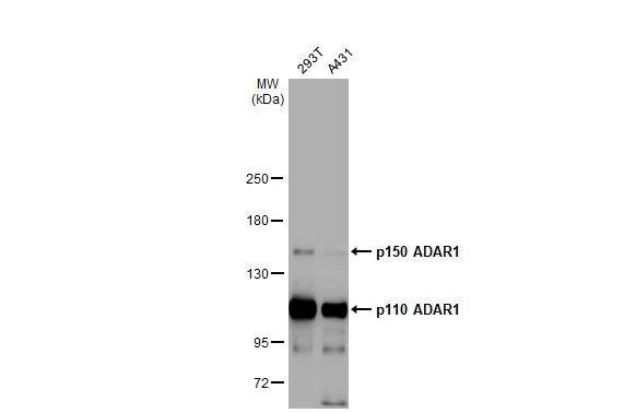 ADAR Antibody (HL1789)