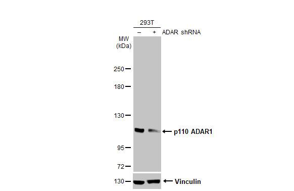 ADAR Antibody (HL1789)