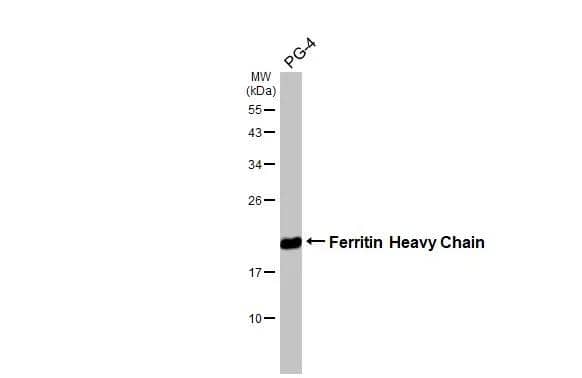 Ferritin Heavy Chain Antibody (HL1905)
