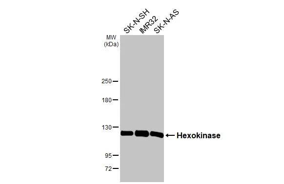 Hexokinase 2 Antibody (HL2000)