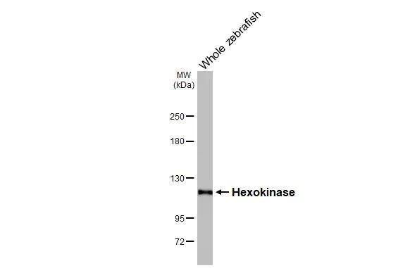 Hexokinase 2 Antibody (HL2000)