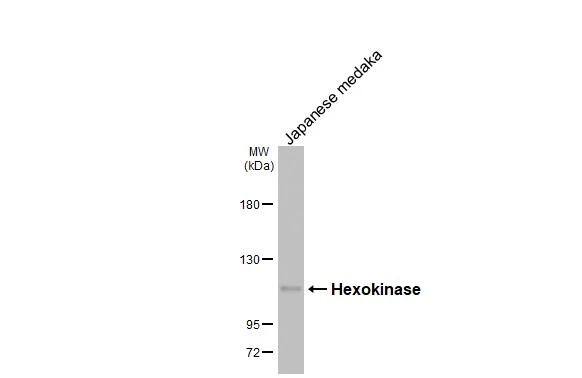 Hexokinase 2 Antibody (HL2000)