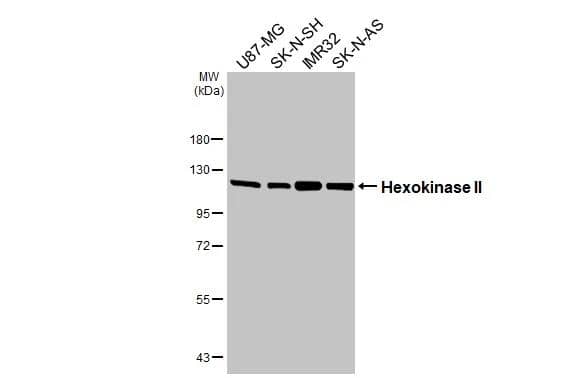 Hexokinase 2 Antibody (HL2001)