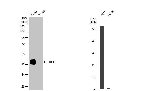 HFE Antibody (HL2155)