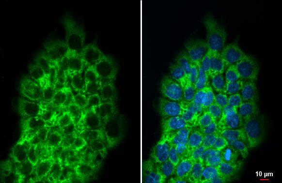 RPLP2 Antibody (HL2256)