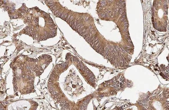 RPLP2 Antibody (HL2256)