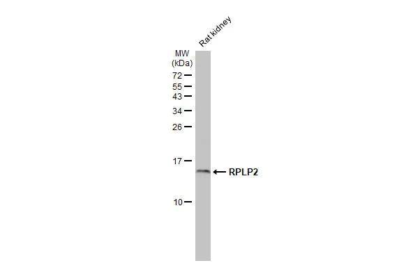 RPLP2 Antibody (HL2256)