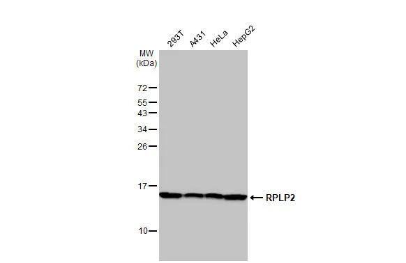 RPLP2 Antibody (HL2256)