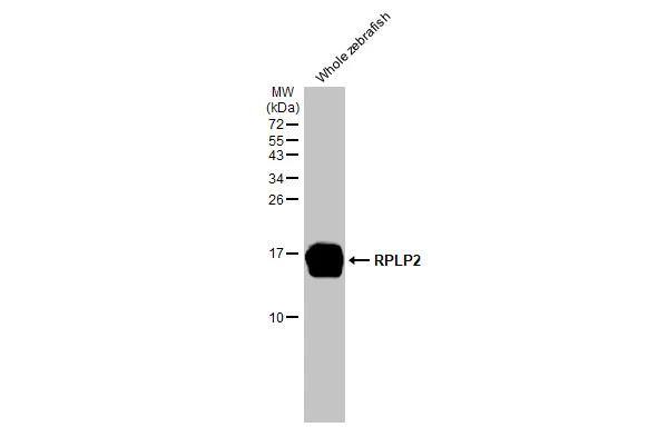 RPLP2 Antibody (HL2256)