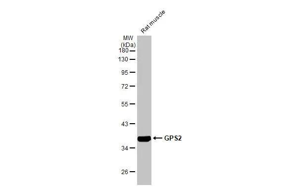 GPS2 Antibody (HL2276)