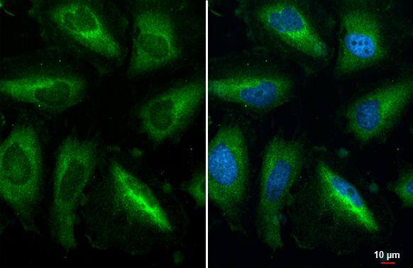 RPL32 Antibody (HL2331)