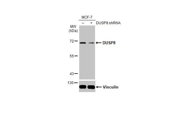 DUSP8 Antibody (HL2338)