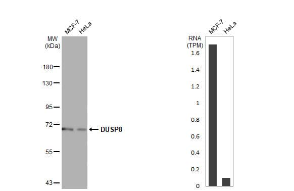DUSP8 Antibody (HL2338)